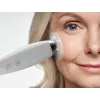 HoMedics MD-1000-EU2 ādas kopšanas ierīce Vakuuma mikrodermabrāzija Balta