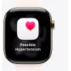 Apple Watch Series 11 GPS 46mm Rožu zelta alumīnija korpuss ar Light Blush Sport siksniņu S/M