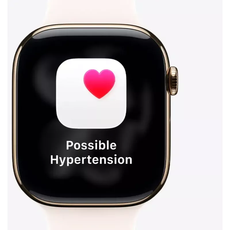 Apple Watch Series 11 GPS 46mm Rožu zelta alumīnija korpuss ar Light Blush Sport siksniņu S/M
